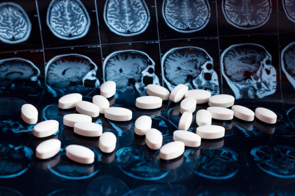 Medicines, drugs placed on top of brain MRI scan